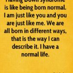 Famous Quotes About Down Syndrome Pinterest
