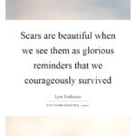 Scars Are Beautiful Quotes Pinterest
